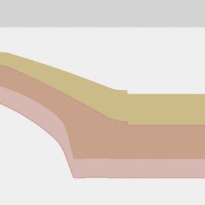 Concave comparison diagram